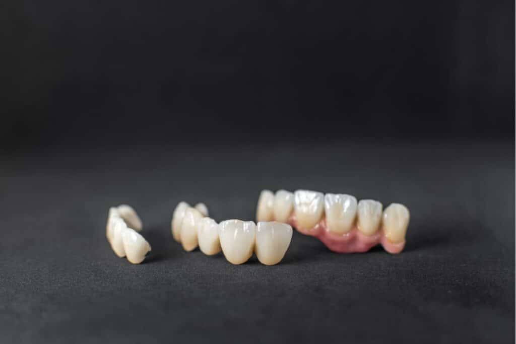 Dental-Crowns