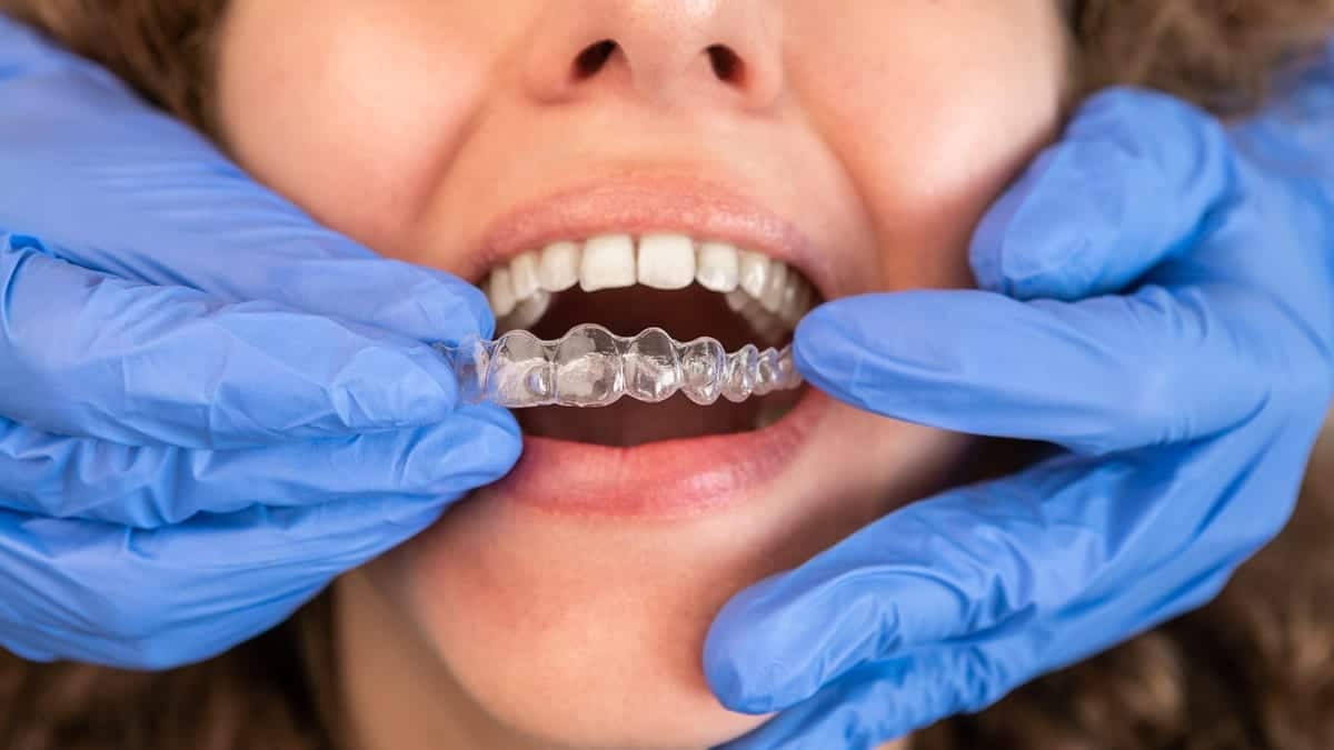 Invisalign in Mountain Home